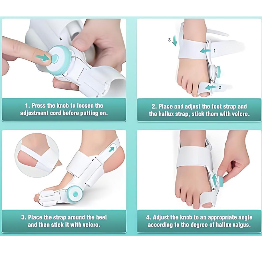 Advanced Bunion corrector